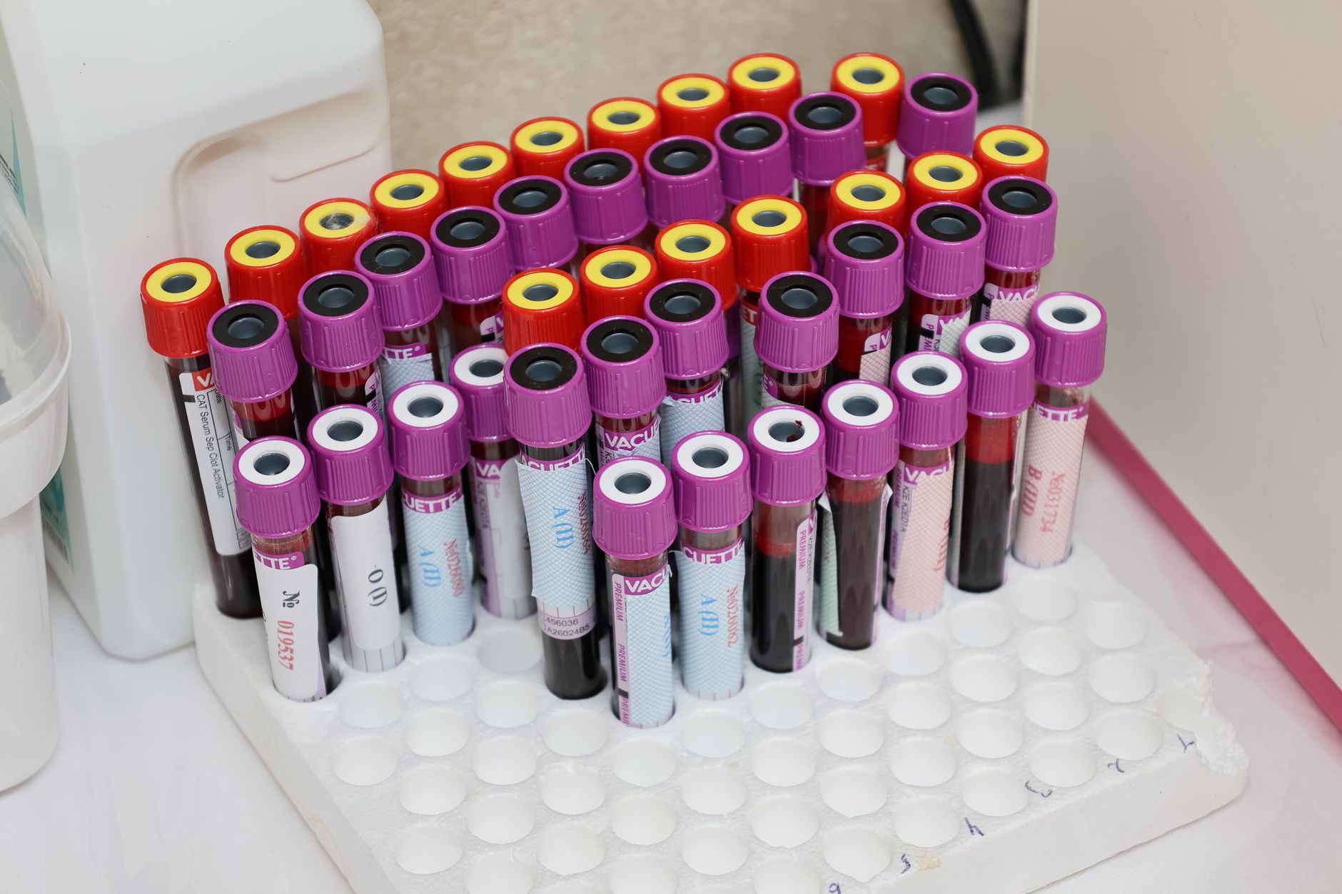 Lab Specimen Pickup and Delivery